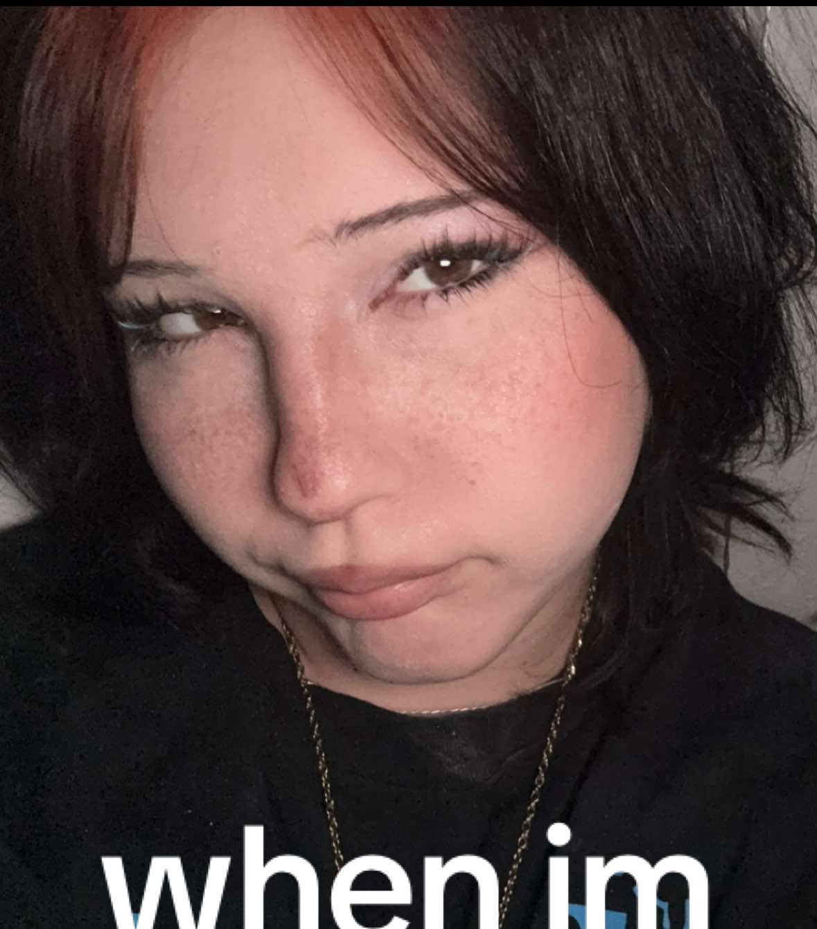 skin picking i can’t stop || #real #fyp #dermatillomania 