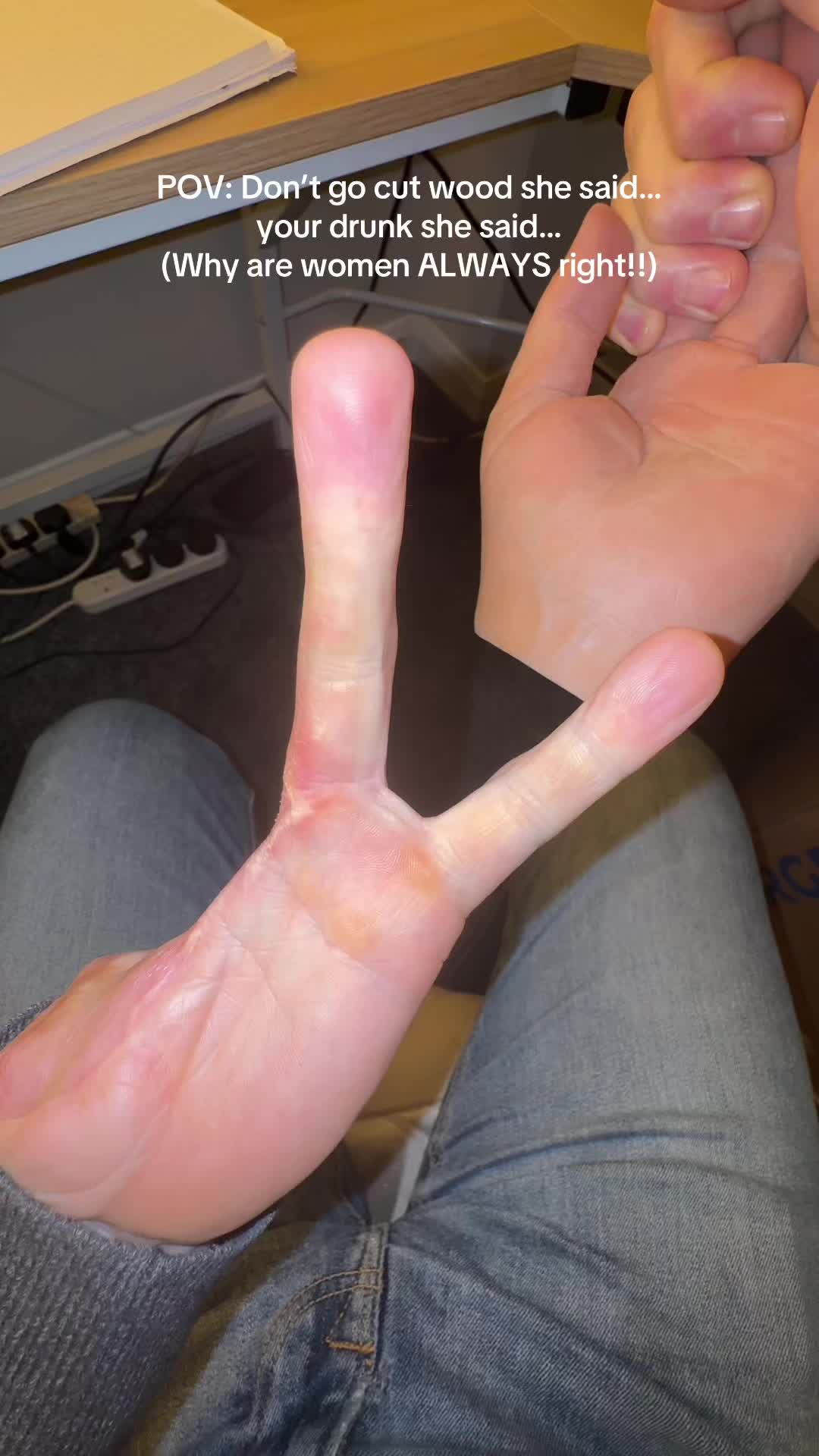 #amputeelife #newyearnewme #thisisnotai 