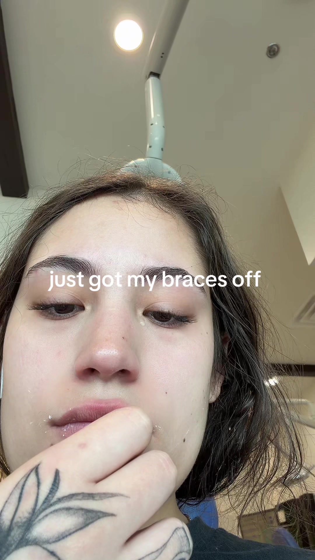 i’m never leaving the house ever again #fyp #viral #satx #braces